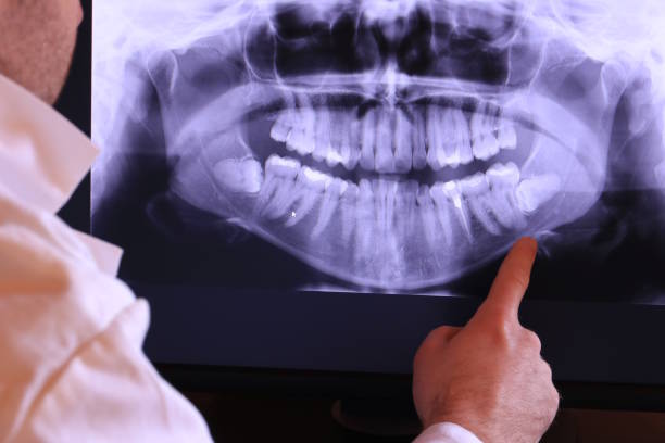 Best Emergency Cosmetic Dentistry in Merrillville, IN